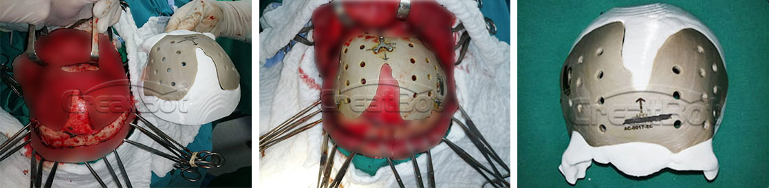 Cranium_01.jpg