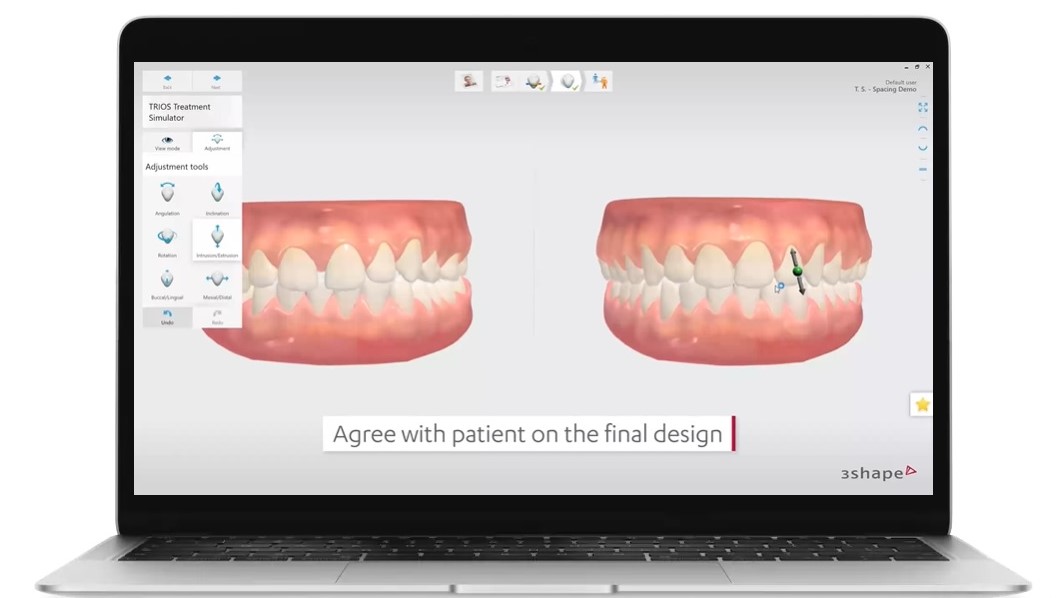 Treatment Simulator.jpg